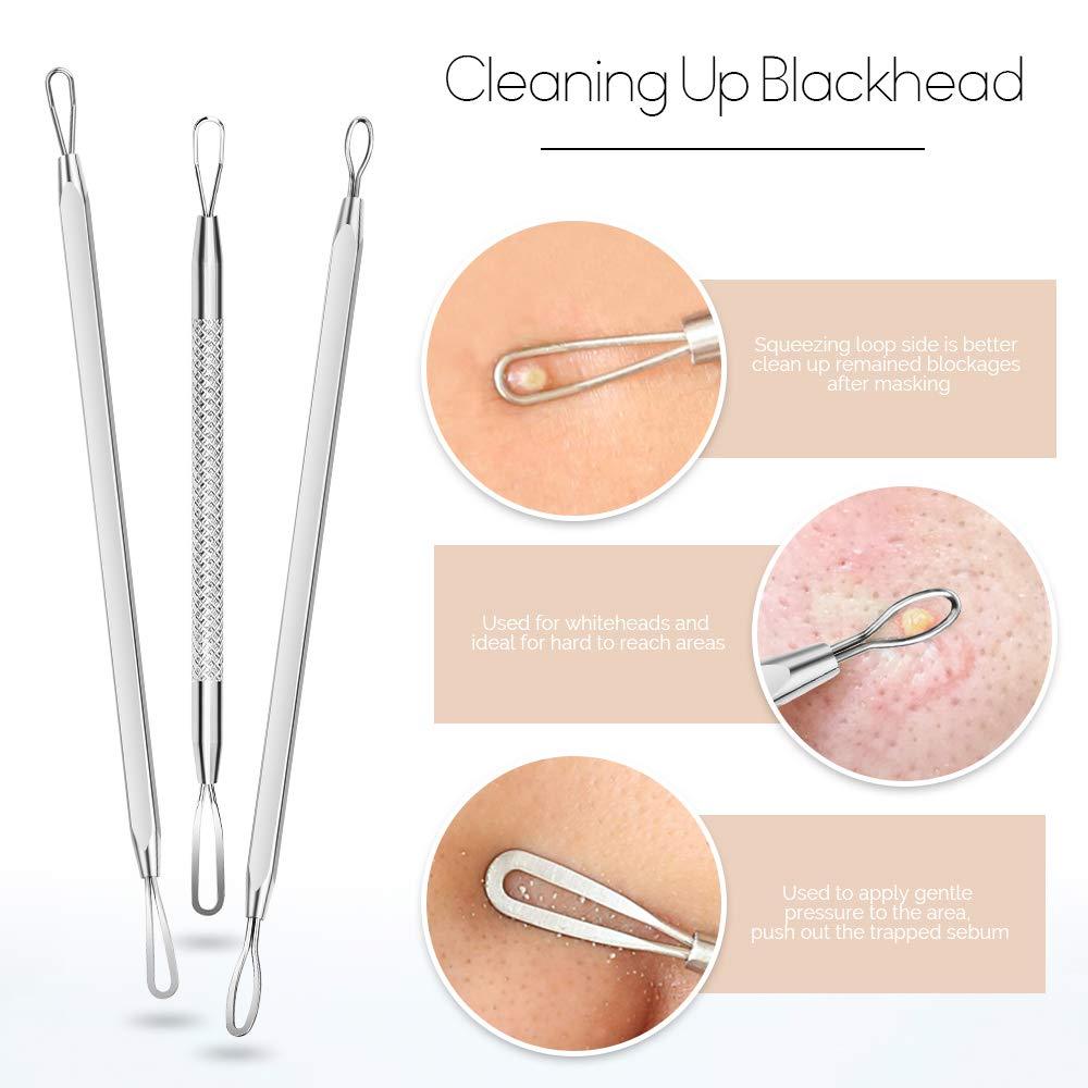 6 Pcs Blackhead Remover Comedone Extractor Tool Acne Removal Tool