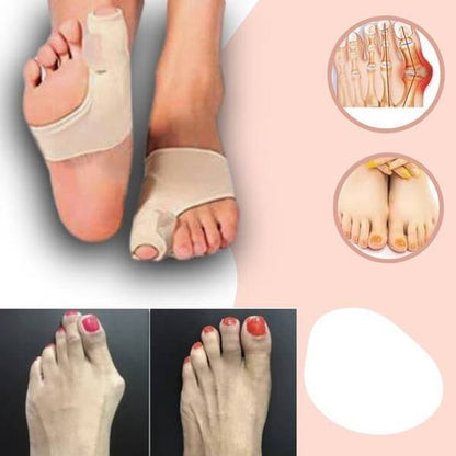 FeelGreat Orthopedic Toe Bunion Corrector 2.0 - 1 Pair (Left & Right)