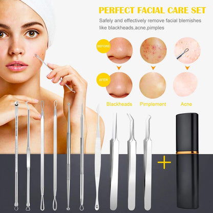 10 Pcs Blackhead Remover Tool Comedone Extractor Removal Tool